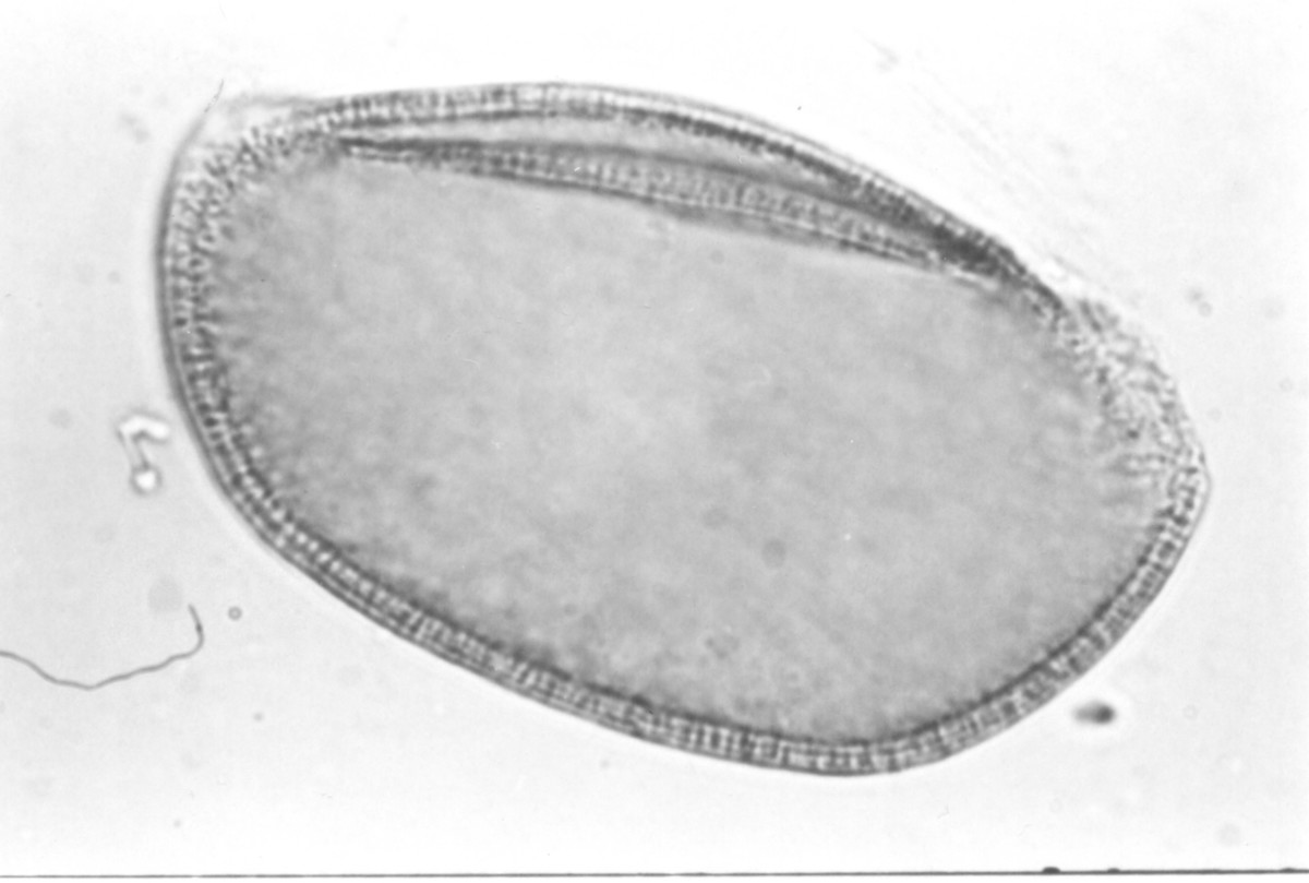 Image - Yucca filamentosa