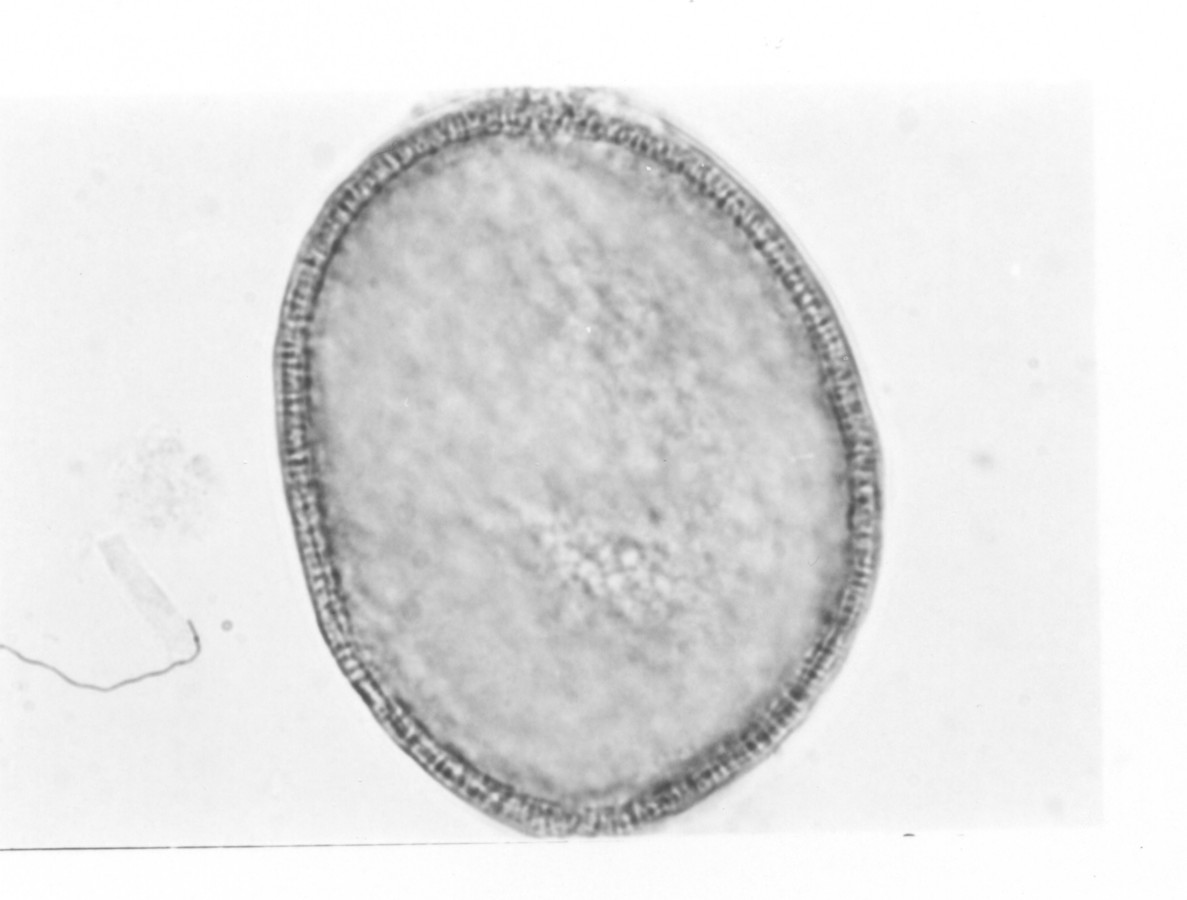 Image - Yucca filamentosa