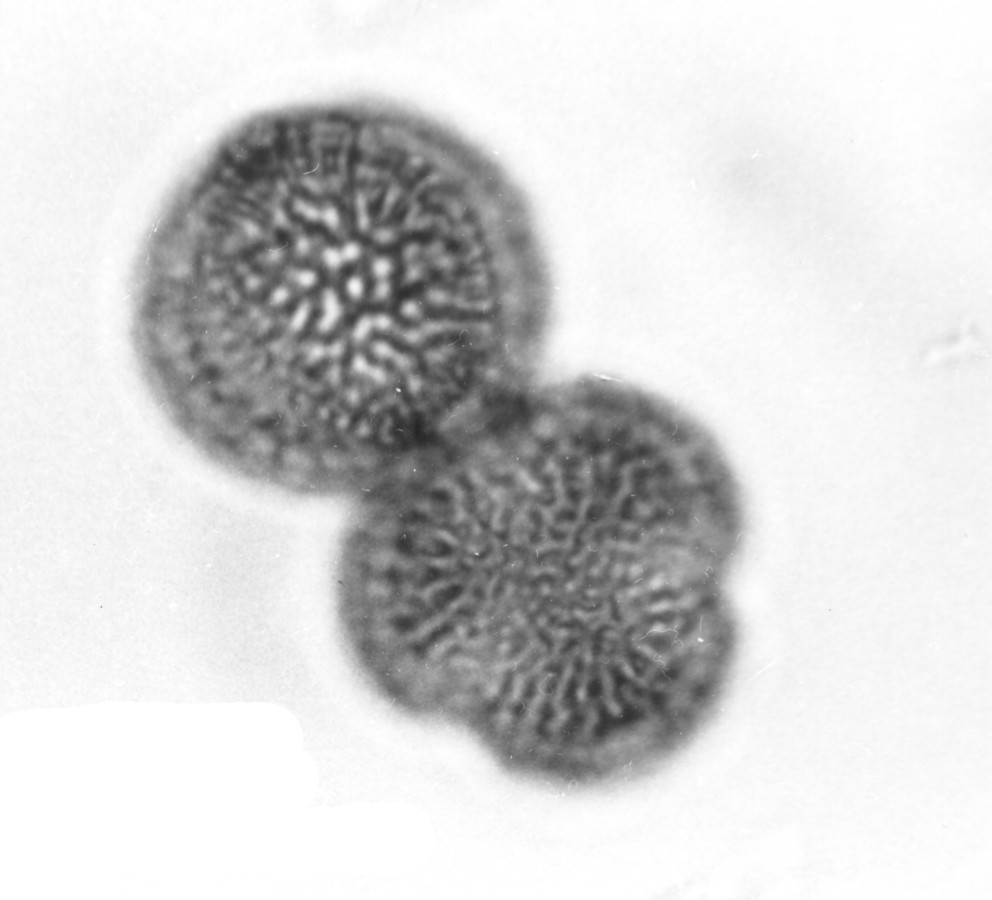 Image - Rapistrum rugosum