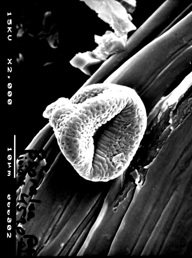 Image - Orbexilum pedunculatum