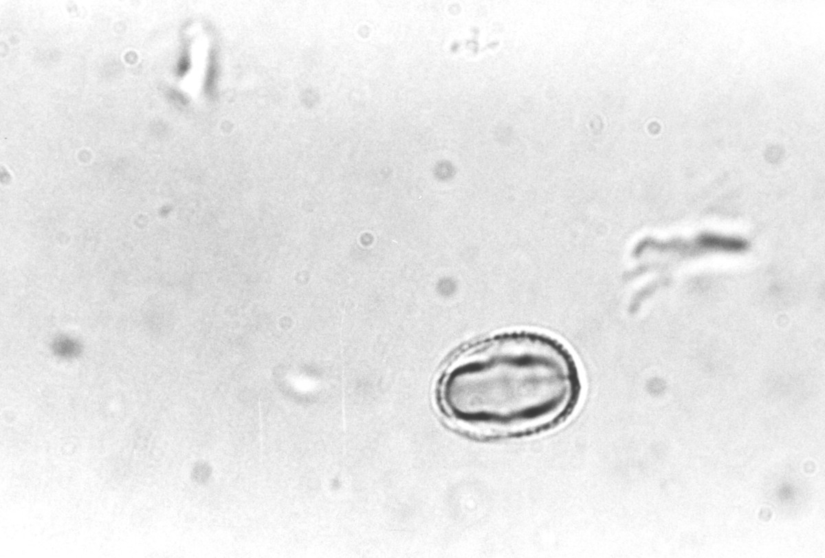 Image - Hypericum hypericoides