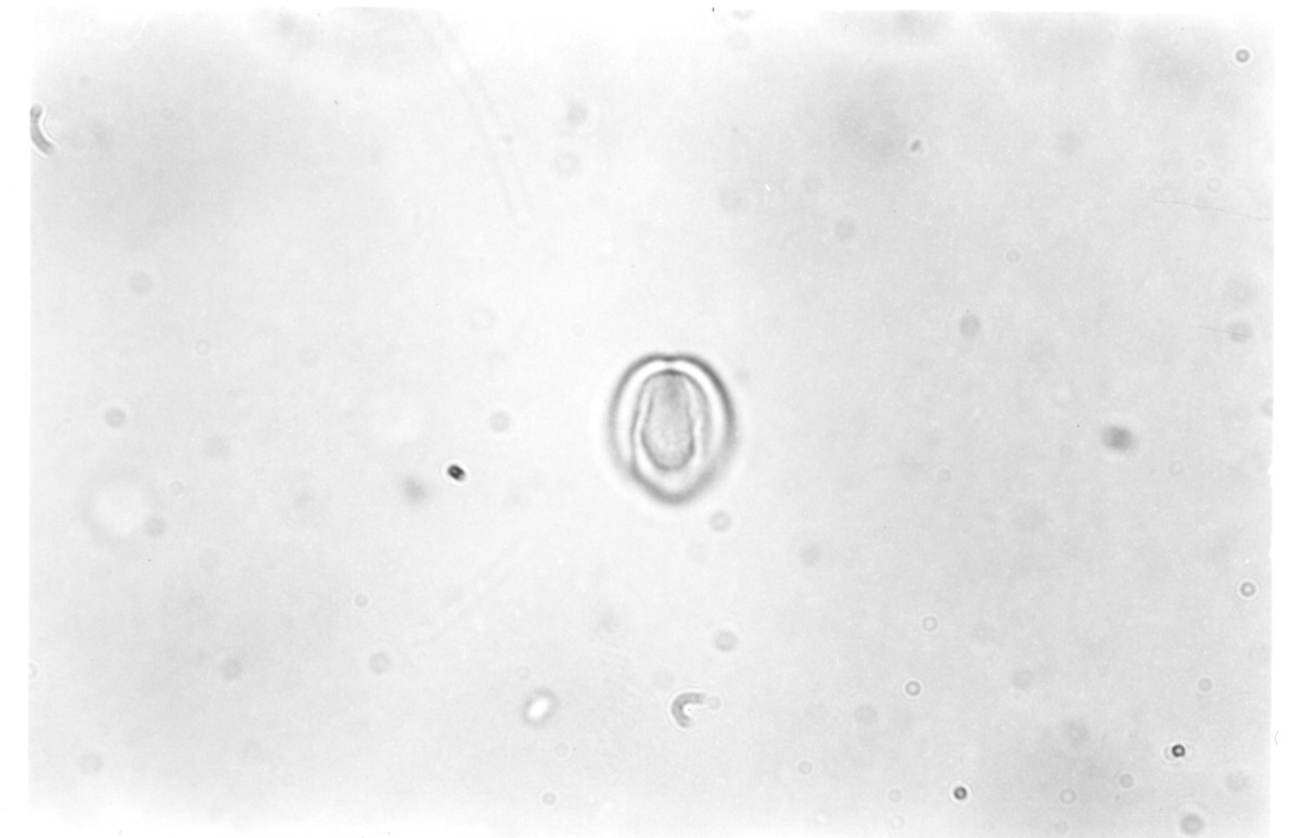 Image - Hypericum lobocarpum